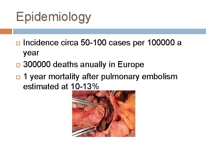 Epidemiology Incidence circa 50 -100 cases per 100000 a year 300000 deaths anually in