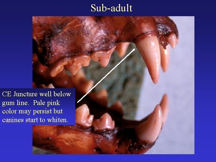Sub-adult CE Juncture well below gum line. Pale pink color may persist but canines