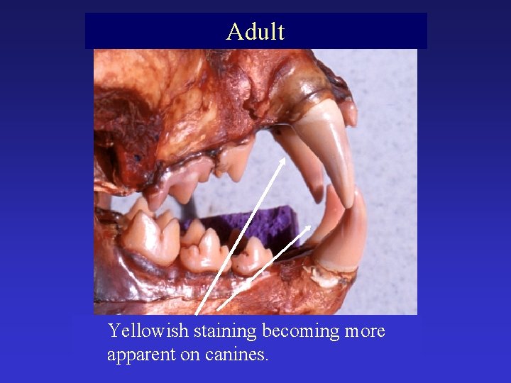 Adult Yellowish staining becoming more apparent on canines. 