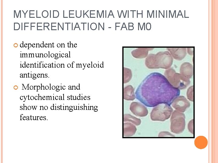 MYELOID LEUKEMIA WITH MINIMAL DIFFERENTIATION - FAB M 0 dependent on the immunological identification