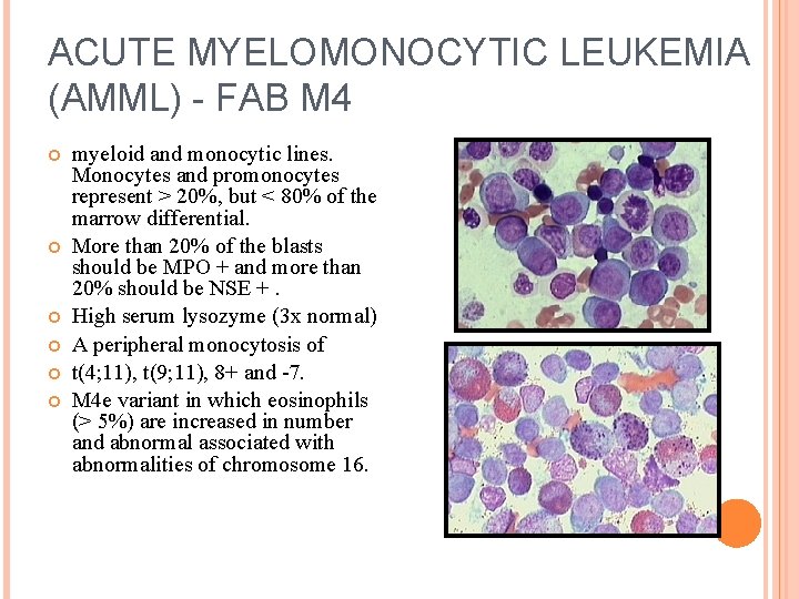 ACUTE MYELOMONOCYTIC LEUKEMIA (AMML) - FAB M 4 myeloid and monocytic lines. Monocytes and