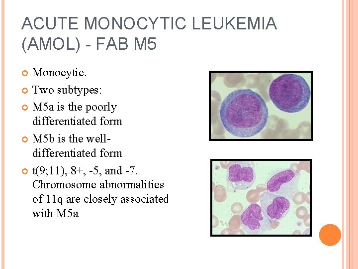 ACUTE MONOCYTIC LEUKEMIA (AMOL) - FAB M 5 Monocytic. Two subtypes: M 5 a