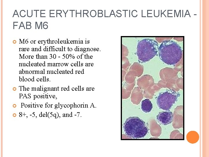 ACUTE ERYTHROBLASTIC LEUKEMIA - FAB M 6 or erythroleukemia is rare and difficult to