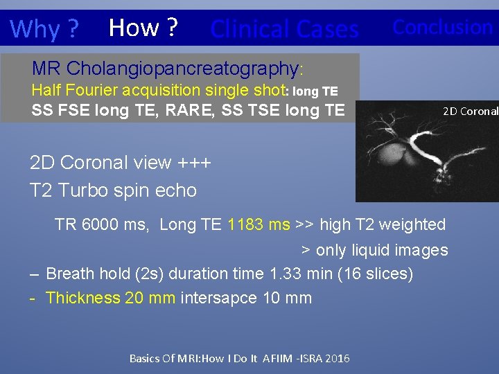 Why ? How ? Clinical Cases Conclusion MR Cholangiopancreatography: Half Fourier acquisition single shot: