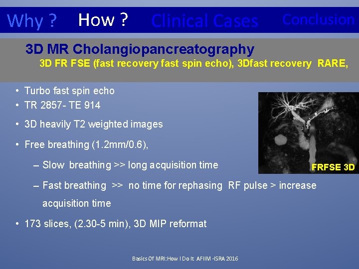 Why ? How ? Clinical Cases Conclusion 3 D MR Cholangiopancreatography 3 D FR