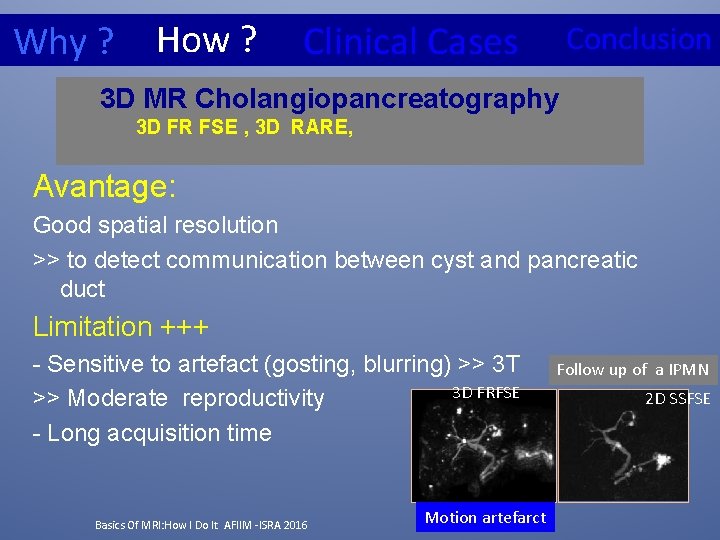 How ? Why ? Clinical Cases Conclusion 3 D MR Cholangiopancreatography 3 D FR