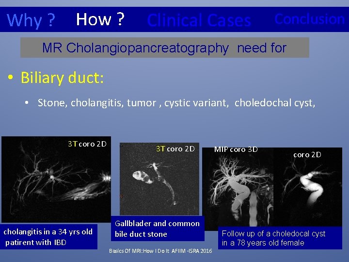 Why ? How ? Clinical Cases Conclusion MR Cholangiopancreatography need for • Biliary duct: