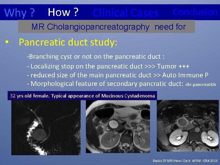 Why ? How ? Clinical Cases Conclusion MR Cholangiopancreatography need for • Pancreatic duct