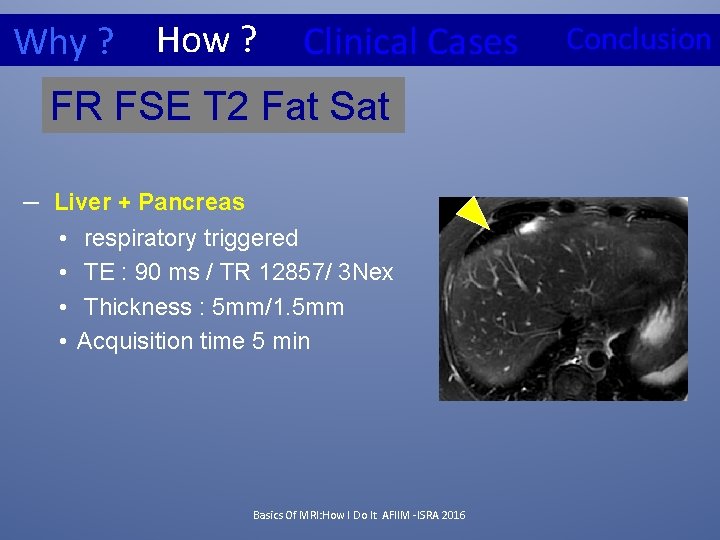 Why ? How ? Clinical Cases FR FSE T 2 Fat Sat – Liver