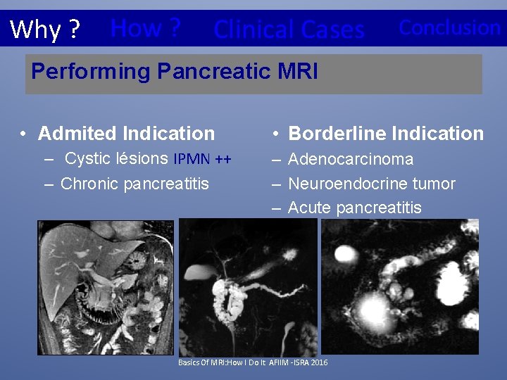 Why ? How ? Clinical Cases Conclusion Performing Pancreatic MRI • Admited Indication –