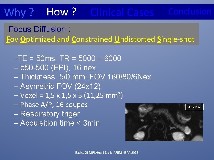 Why ? How ? Clinical Cases Conclusion Focus Diffusion : Fov Optimized and Constrained