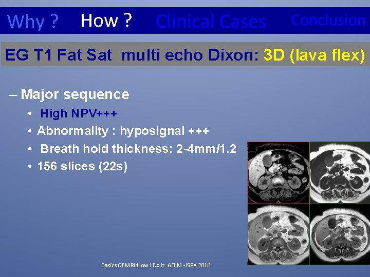 How ? Why ? Clinical Cases Conclusion EG T 1 Fat Sat multi echo