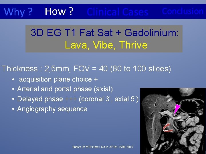 How ? Why ? Clinical Cases Conclusion 3 D EG T 1 Fat Sat