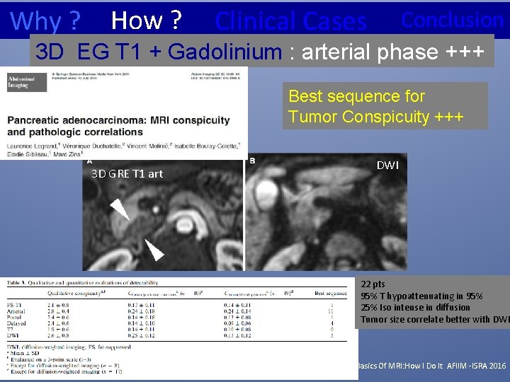 Why ? How ? Clinical Cases Conclusion 3 D EG T 1 + Gadolinium