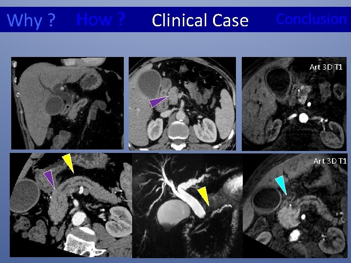 Why ? How ? Clinical Case Conclusion 3 D Art. T 1 3 Dart