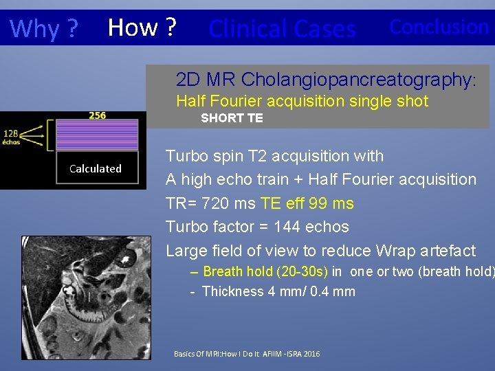 Why ? How ? Clinical Cases Conclusion 2 D MR Cholangiopancreatography: Half Fourier acquisition