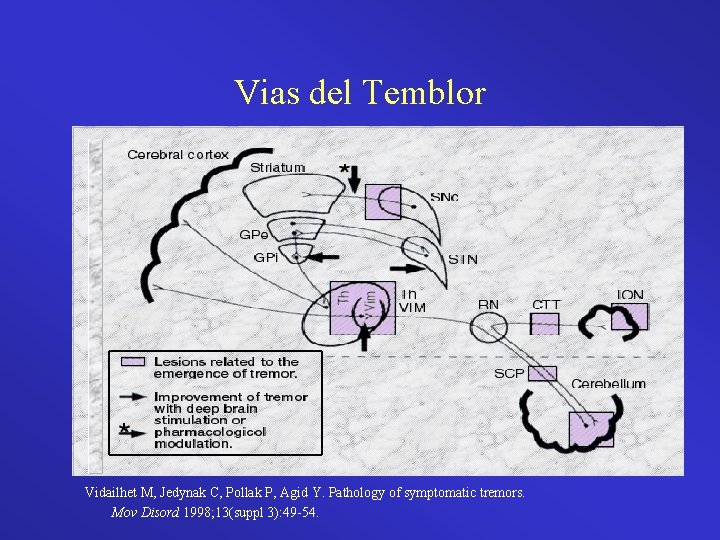 Vias del Temblor Vidailhet M, Jedynak C, Pollak P, Agid Y. Pathology of symptomatic