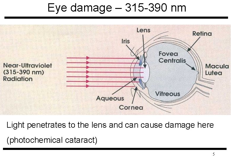 Eye damage – 315 -390 nm Light penetrates to the lens and can cause