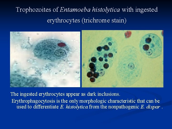 Trophozoites of Entamoeba histolytica with ingested erythrocytes (trichrome stain) E F The ingested erythrocytes