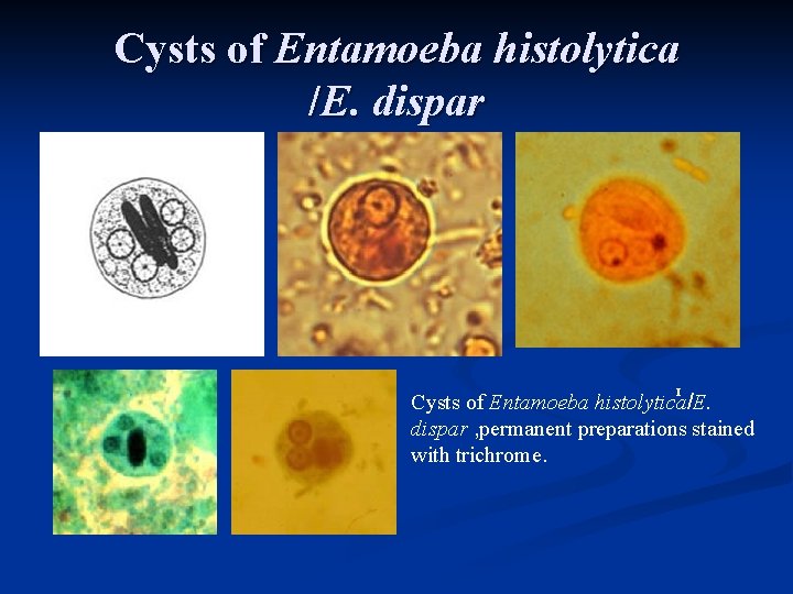 Cysts of Entamoeba histolytica /E. dispar n GHI H I Cysts of Entamoeba histolytica/E.