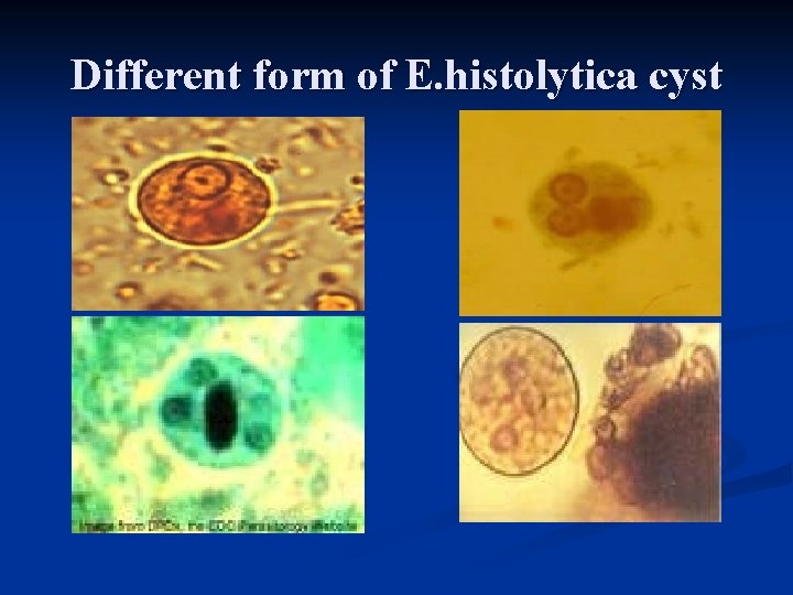 Different form of E. histolytica cyst 