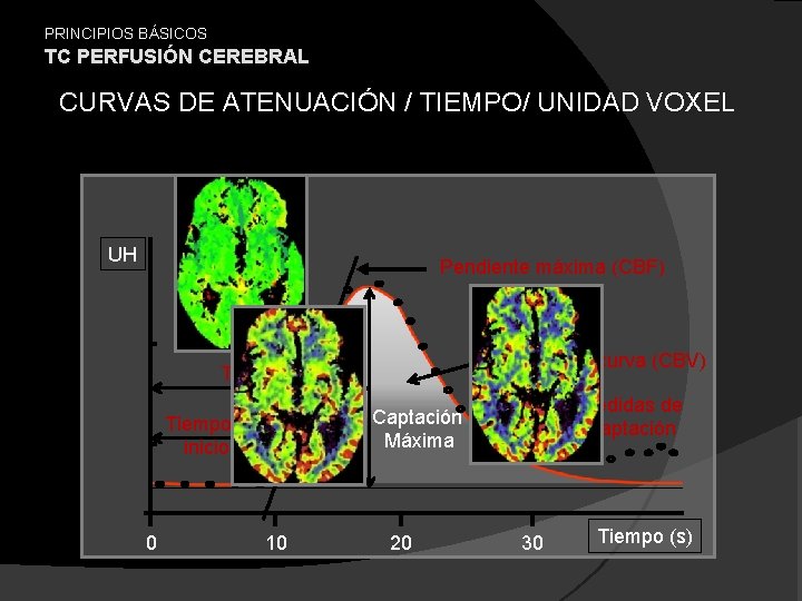 PRINCIPIOS BÁSICOS TC PERFUSIÓN CEREBRAL CURVAS DE ATENUACIÓN / TIEMPO/ UNIDAD VOXEL UH Pendiente