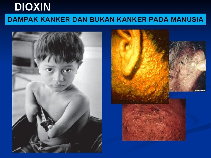 DIOXIN DAMPAK KANKER DAN BUKAN KANKER PADA MANUSIA 