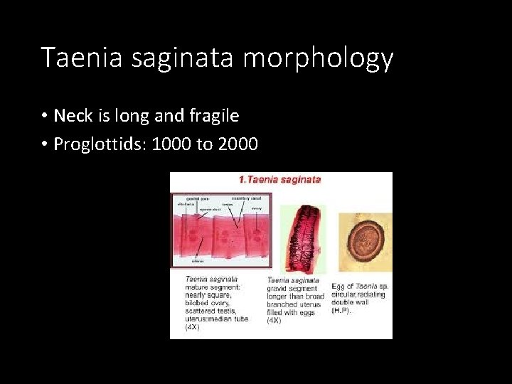 Taenia saginata morphology • Neck is long and fragile • Proglottids: 1000 to 2000