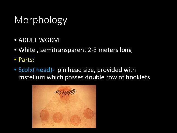 Morphology • ADULT WORM: • White , semitransparent 2 -3 meters long • Parts: