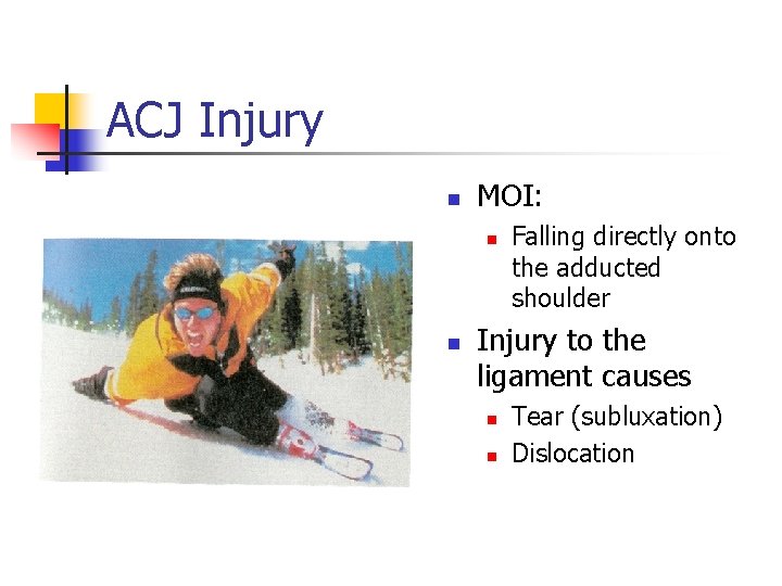 ACJ Injury n MOI: n n Falling directly onto the adducted shoulder Injury to