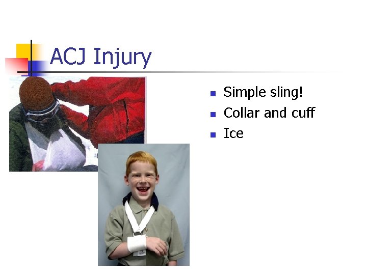 ACJ Injury n n n Simple sling! Collar and cuff Ice 