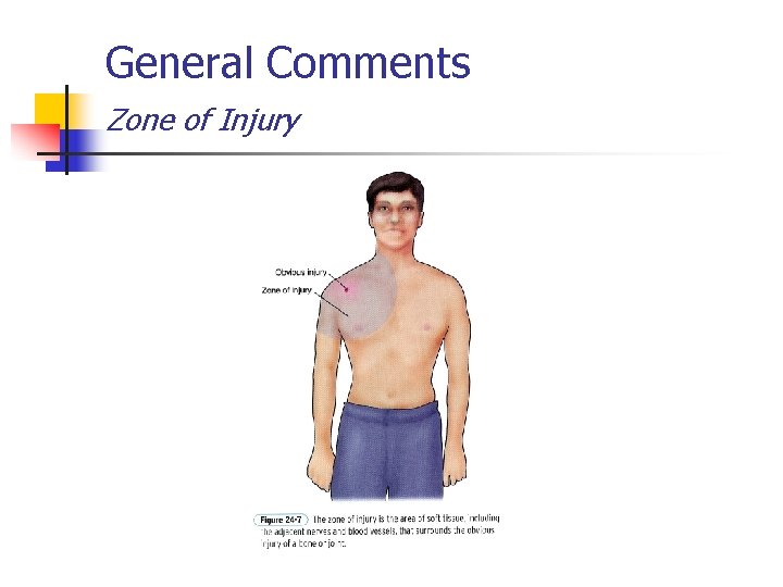 General Comments Zone of Injury 