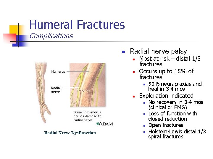 Humeral Fractures Complications n Radial nerve palsy n n Most at risk – distal