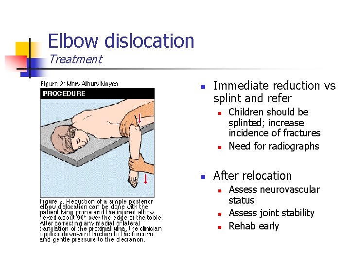 Elbow dislocation Treatment n Immediate reduction vs splint and refer n n n Children