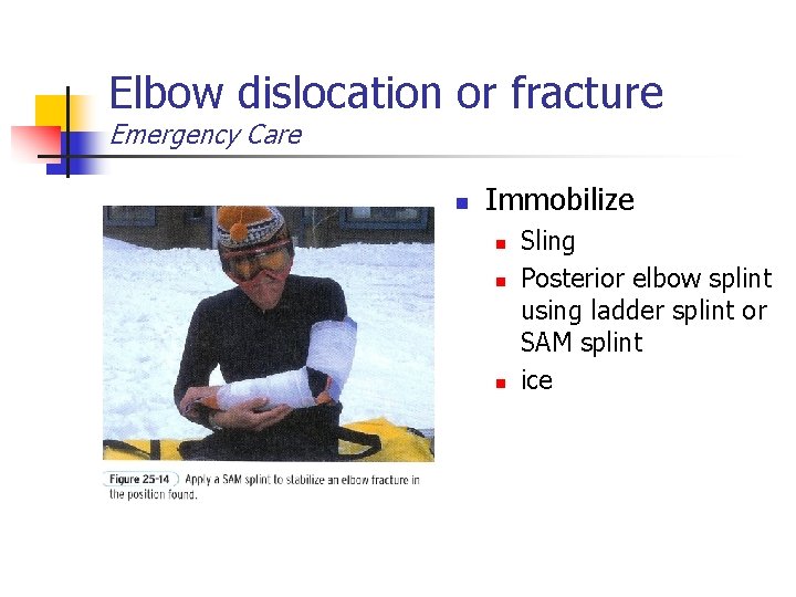 Elbow dislocation or fracture Emergency Care n Immobilize n n n Sling Posterior elbow