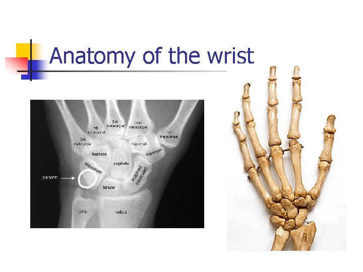 Anatomy of the wrist 