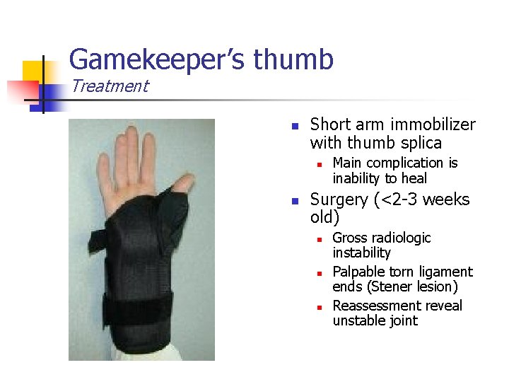 Gamekeeper’s thumb Treatment n Short arm immobilizer with thumb splica n n Main complication