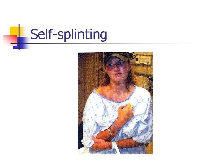 Self-splinting 