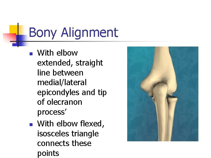 Bony Alignment n n With elbow extended, straight line between medial/lateral epicondyles and tip