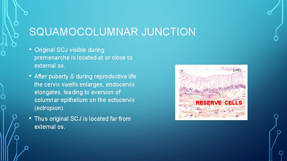 SQUAMOCOLUMNAR JUNCTION • Original SCJ visible during premenarche is located at or close to