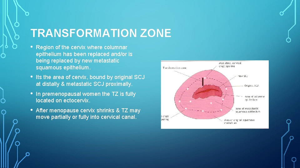 TRANSFORMATION ZONE • Region of the cervix where columnar epithelium has been replaced and/or