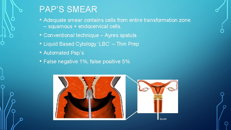 PAP’S SMEAR • Adequate smear contains cells from entire transformation zone – squamous +