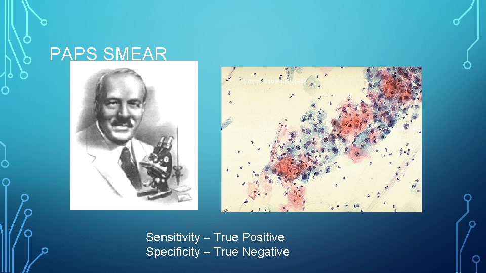 PAPS SMEAR Normal squamous cells Dysplastic cells Sensitivity – True Positive Specificity – True