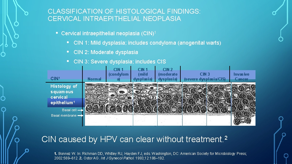 CLASSIFICATION OF HISTOLOGICAL FINDINGS: CERVICAL INTRAEPITHELIAL NEOPLASIA • Cervical intraepithelial neoplasia (CIN)1 • •