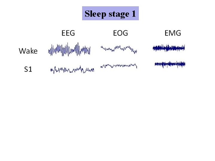 Sleep stage 1 