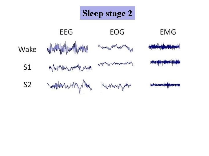 Sleep stage 2 