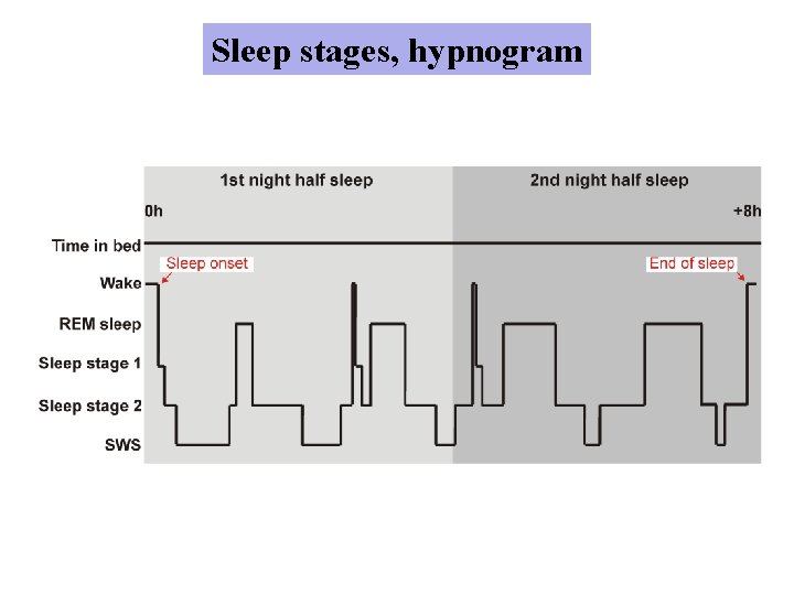 Sleep stages, hypnogram 