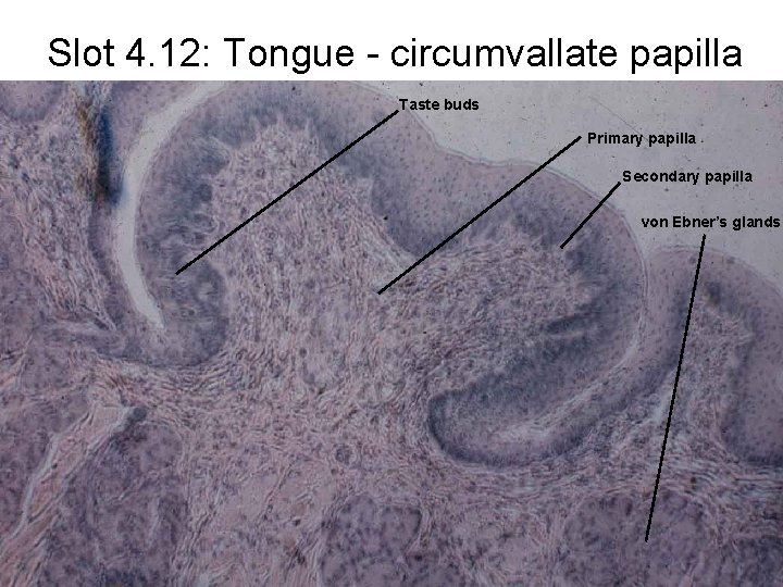 Slot 4. 12: Tongue - circumvallate papilla Taste buds Primary papilla Secondary papilla von