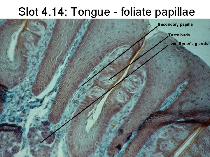 Slot 4. 14: Tongue - foliate papillae Secondary papilla Taste buds von Ebner’s glands