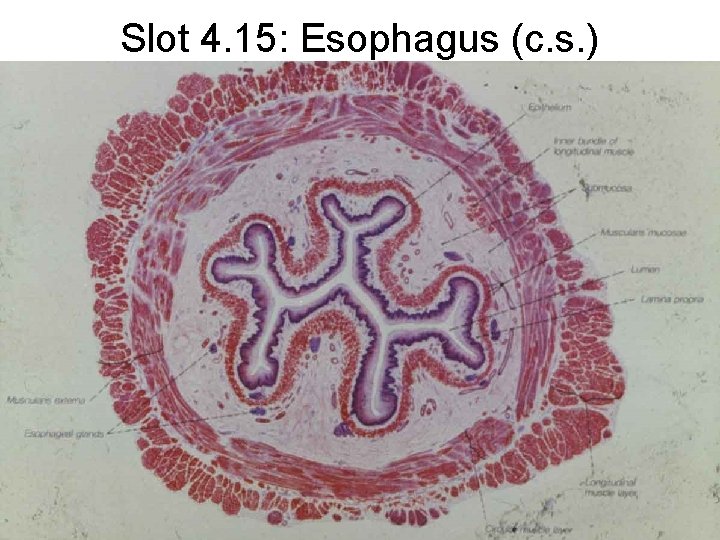 Slot 4. 15: Esophagus (c. s. ) 